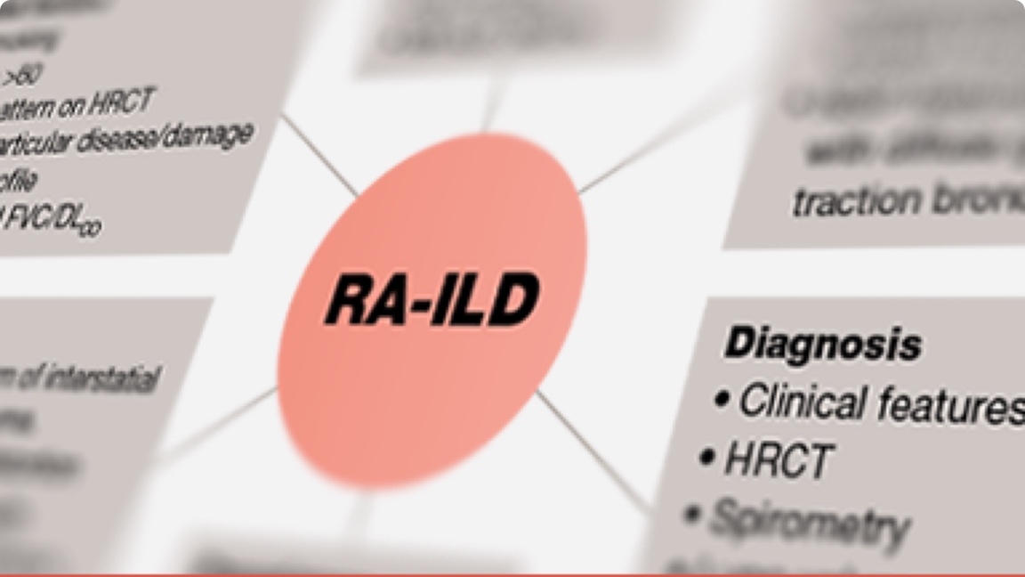 Prevalence Of Rheumatoid Arthrisis Ild 7756