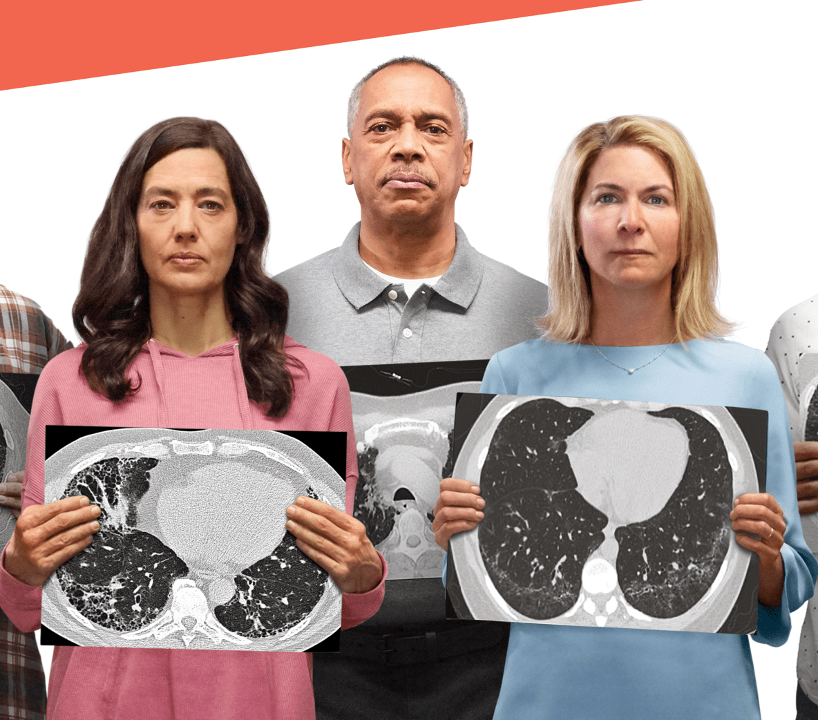 A man and two women hold up lung scans