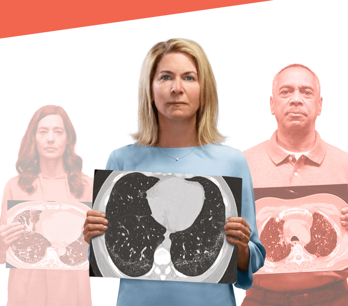 Woman holding up a lung scan