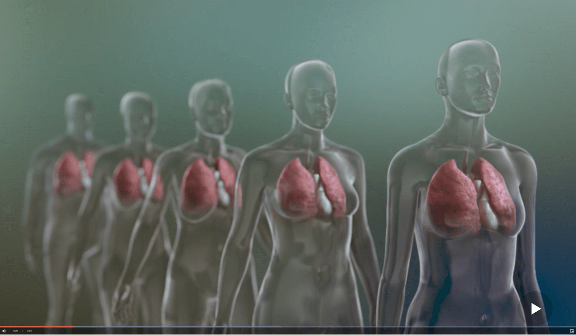 Video still: Interstitial lung diseases (ILDs) and progressive fibrotic phenotype video / A row of transparent people with their lungs visible