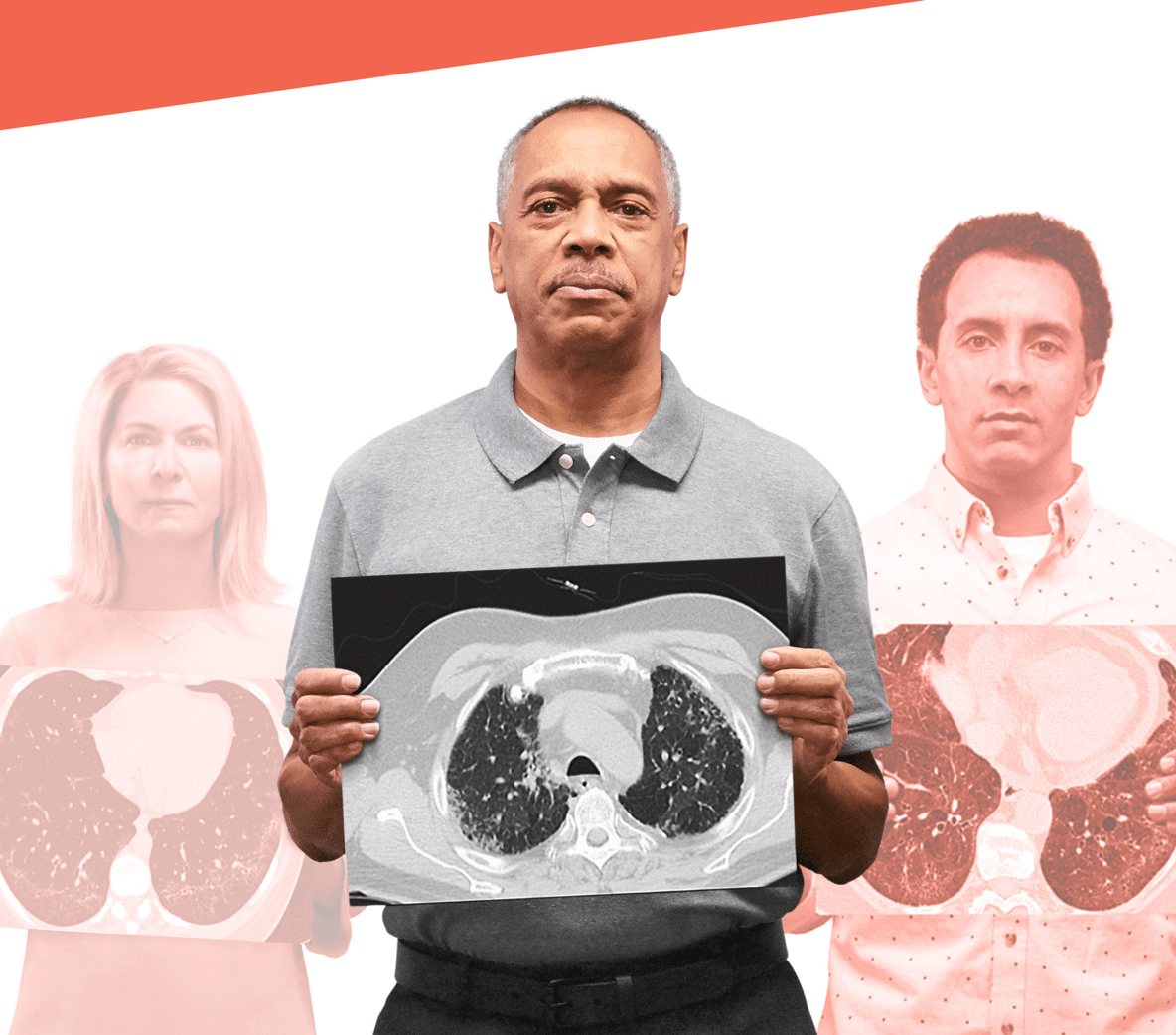 Man holding up a Lung Scan